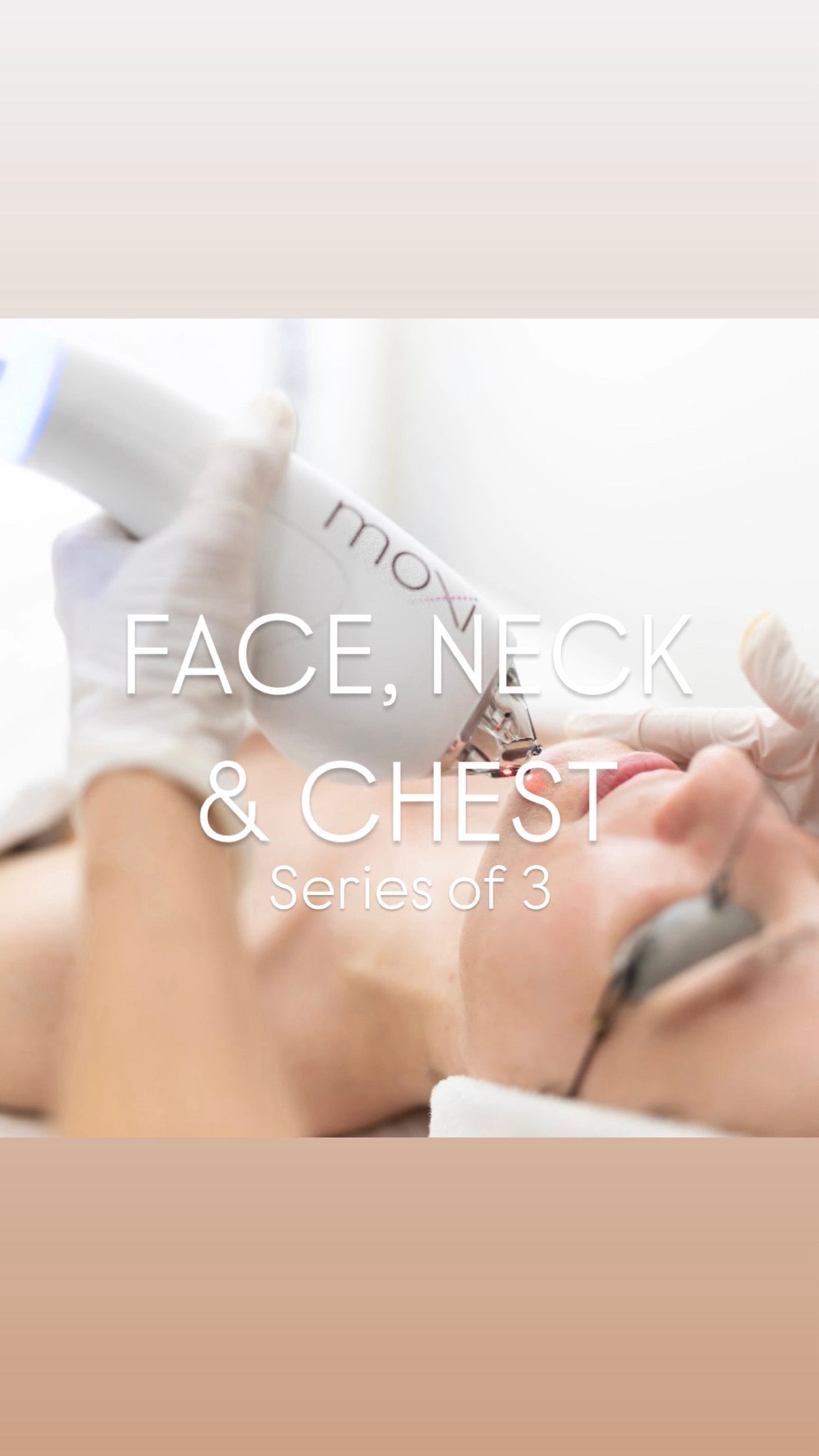 * MOXI Fractional Laser Trifecta: FACE, NECK & CHEST (non-ablative) Series of 3 (Save $600)