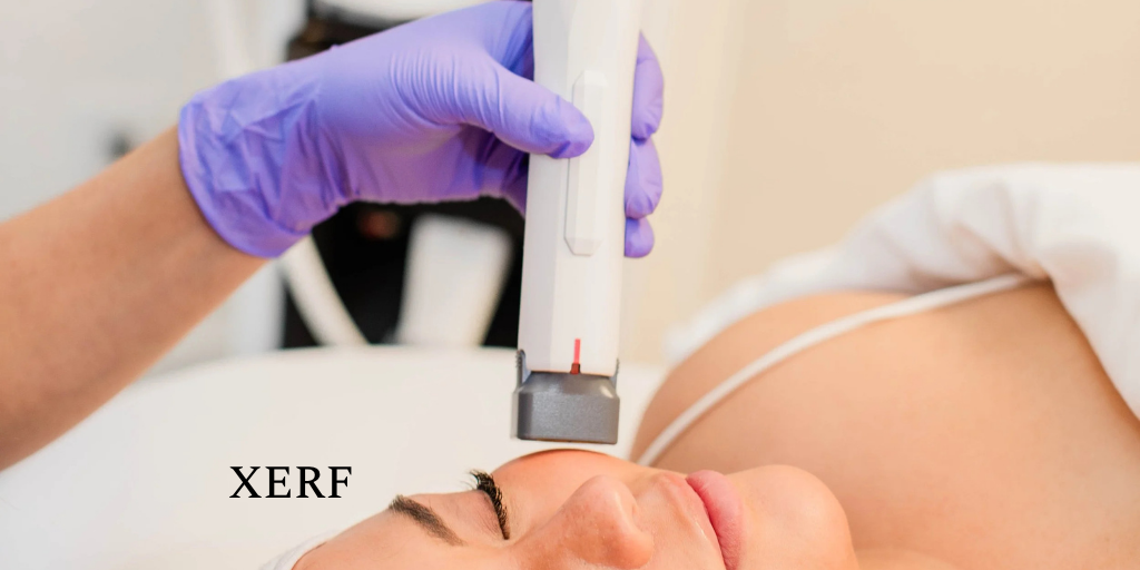 * XERF Skin Tightening: You Get: 1 XERF+ $300 credit toward your 2nd XERF (TAP here for full description)