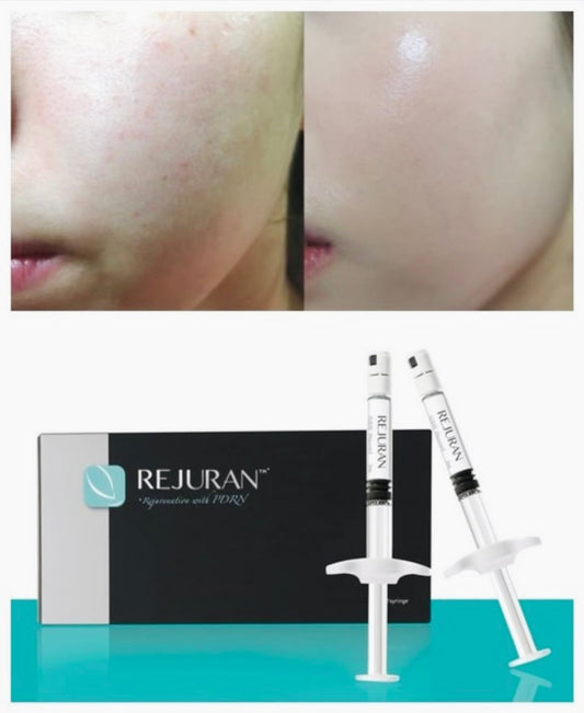 * Rejuran Healer (Add-On to Microneedling, MOXI or RF Microneedling)