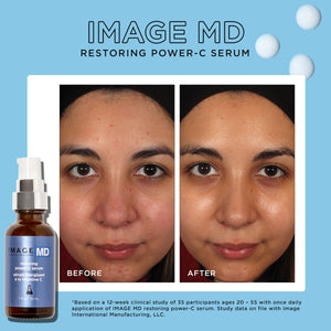 Image Skincare IMAGE MD® restoring power-C serum