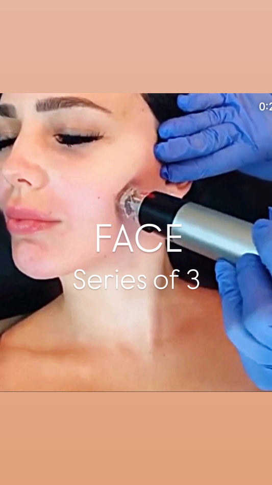 * GENIUS RF-MICRONEEDLING: Face Series of 3 ($650/tx)