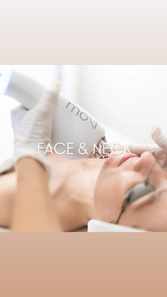 * MOXI Fractional Laser Treatment (non-ablative): FACE & NECK