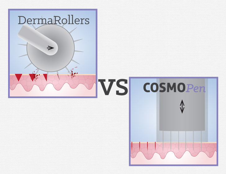 * TRADITIONAL MICRONEEDLING w/ REJURAN HEALER (Salmon DNA) Emmanuel Skinscience