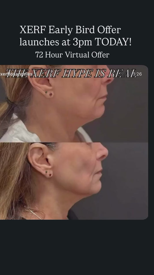 * XERF Skin Tightening: You Get: 1 XERF+ $600 credit toward your 2nd XERF (TAP here for full description)